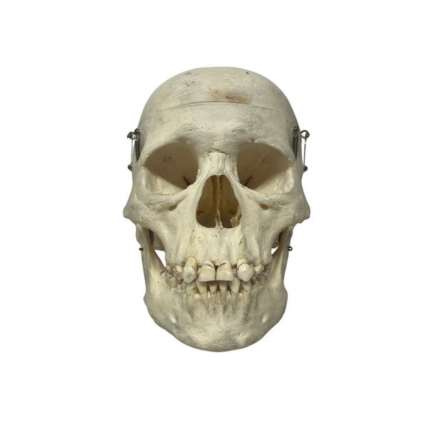 Human skull (B)