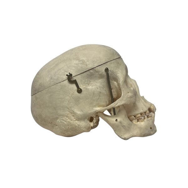 Human skull (B)