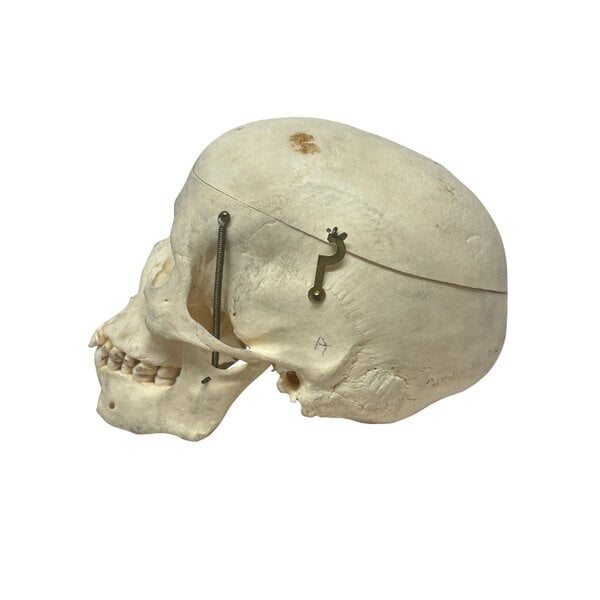Human skull (B)