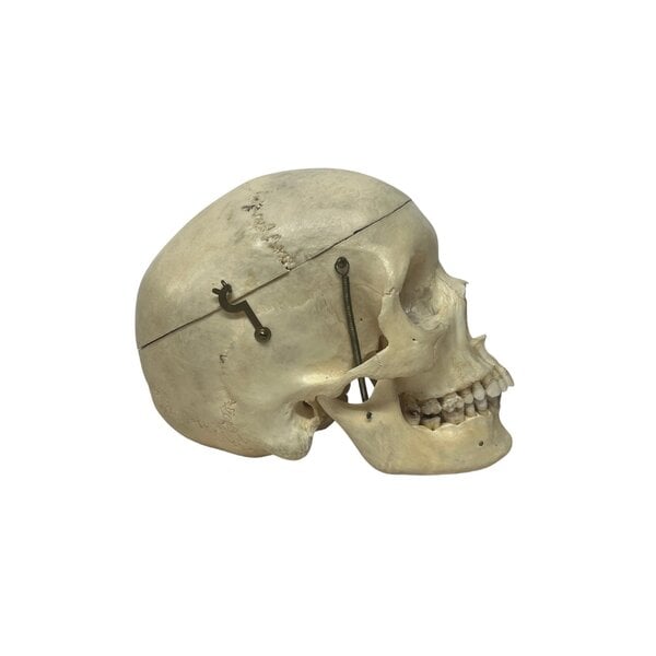 Human skull (E)