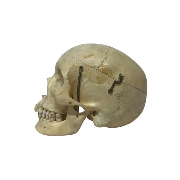 Human skull (E)