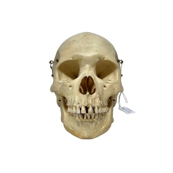 Human skull (G)