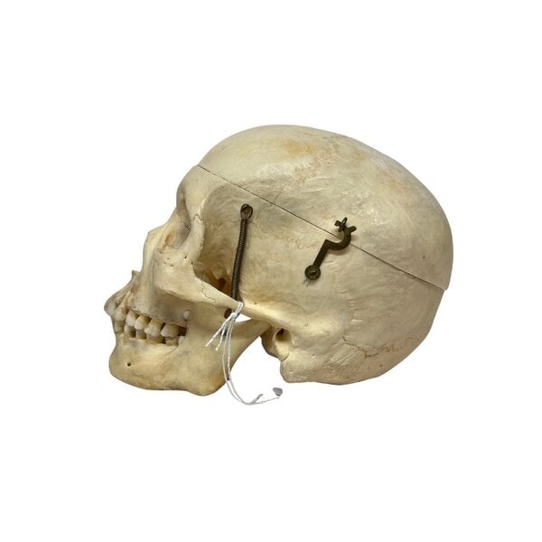 Human skull (G)