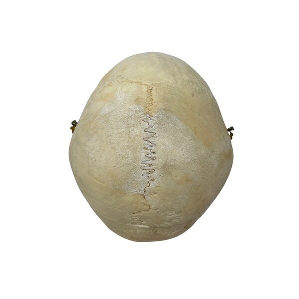 Human skull (G)