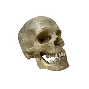 Schedel mens (F)