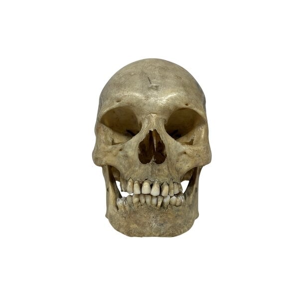 Schedel mens (F)