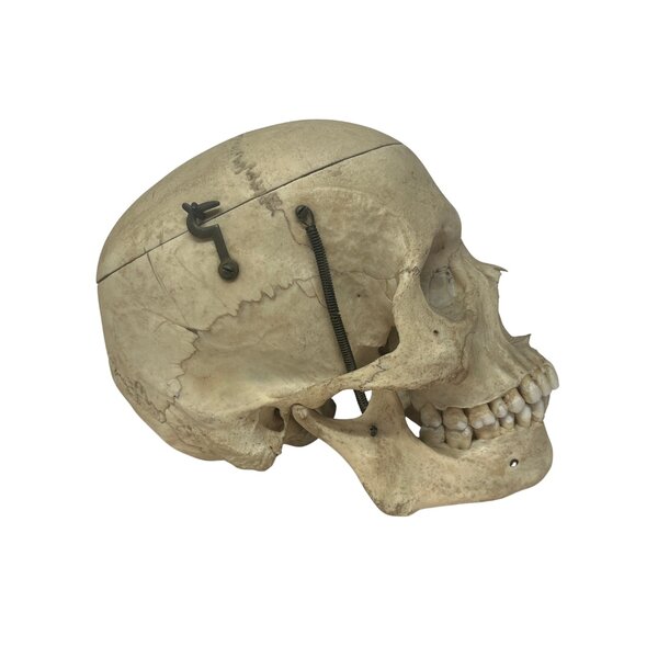 Human skull (A)