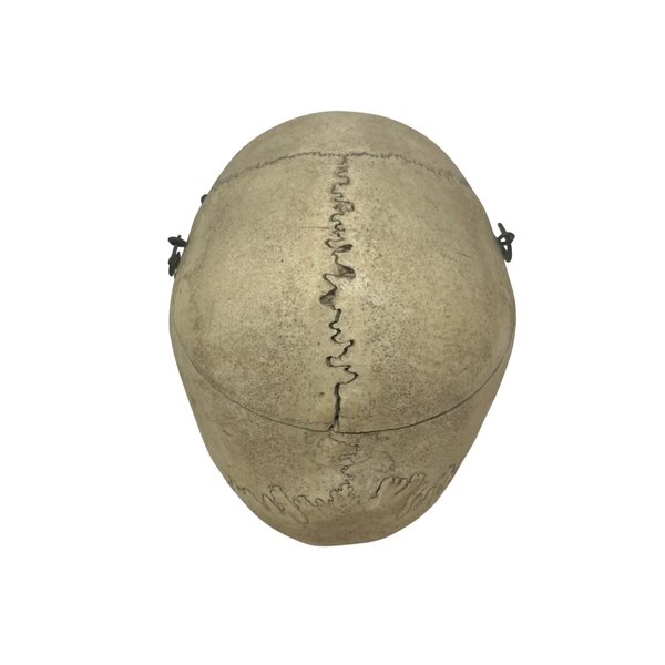 Human skull (A)