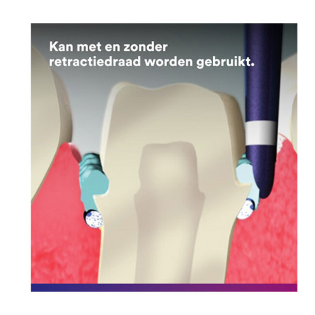 3M™ ASTRINGENT RETRACTION PASTE PACK -  56944