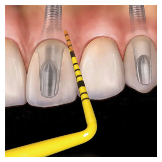 COLORVUE™ PROBE KIT WILLIAMS #PCVPROMOWM