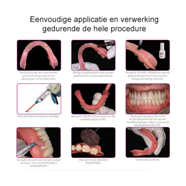 GC RELINE™ II EXTRA SOFT -  CARTRIDGE