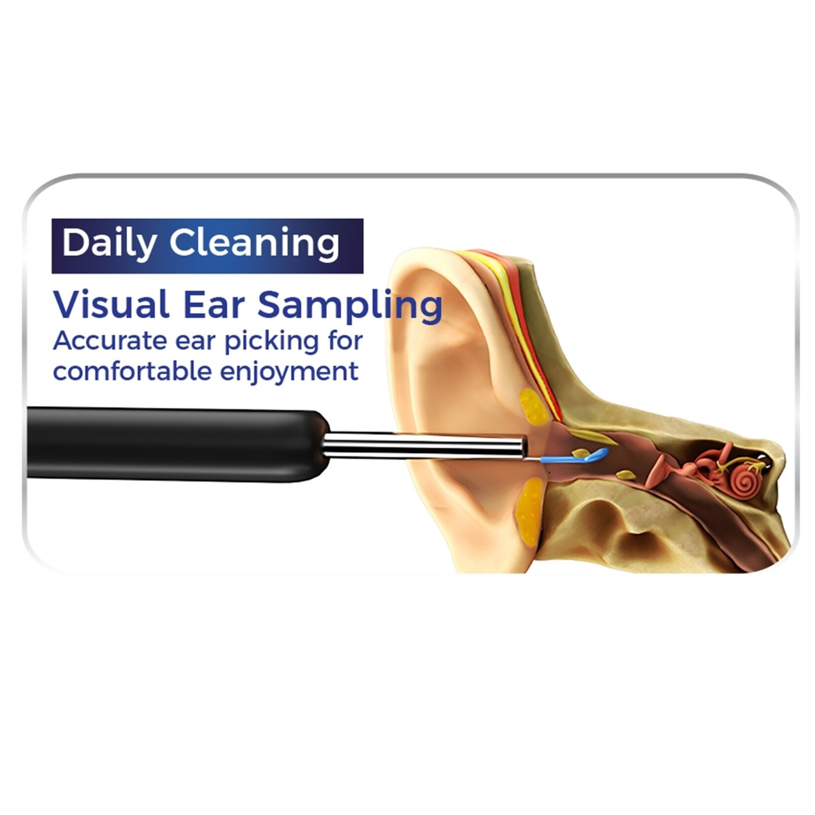 Nexxt NEXXT Ear Wizard Oorreiniger met Camera en Appfunctie - 720P