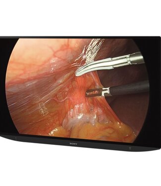 Sony Sony 55 inch 4K 3D/2D Surgical Display LMD-XH550MT