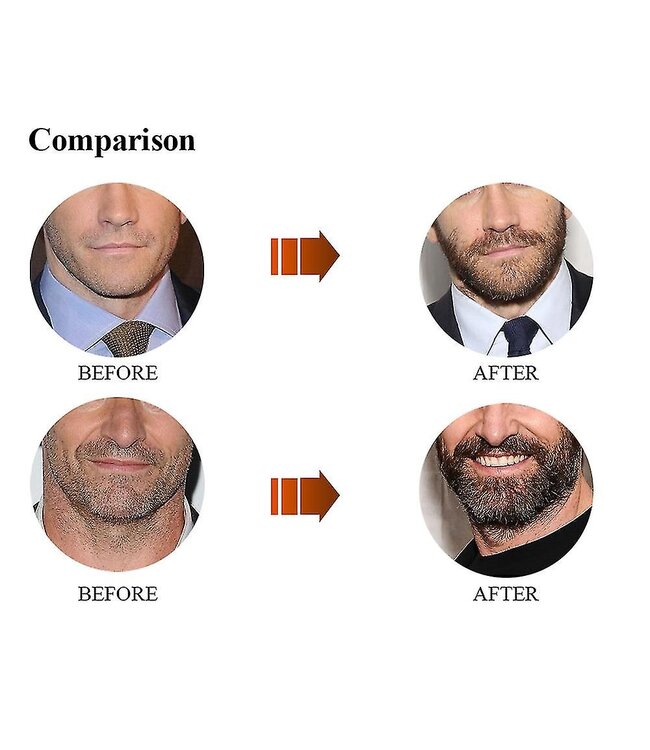 Envisha Beard Growth Set