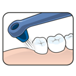 TePe TePe Interspace Medium tandenborstel (incl. 12 tips)