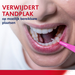 Parodontax Interdentale Ragers 0,4mm ISO 0 Roze - 6 stuks Parodontax Parodontax Interdentale Ragers 0,4mm ISO 0 Roze - 6 stuks