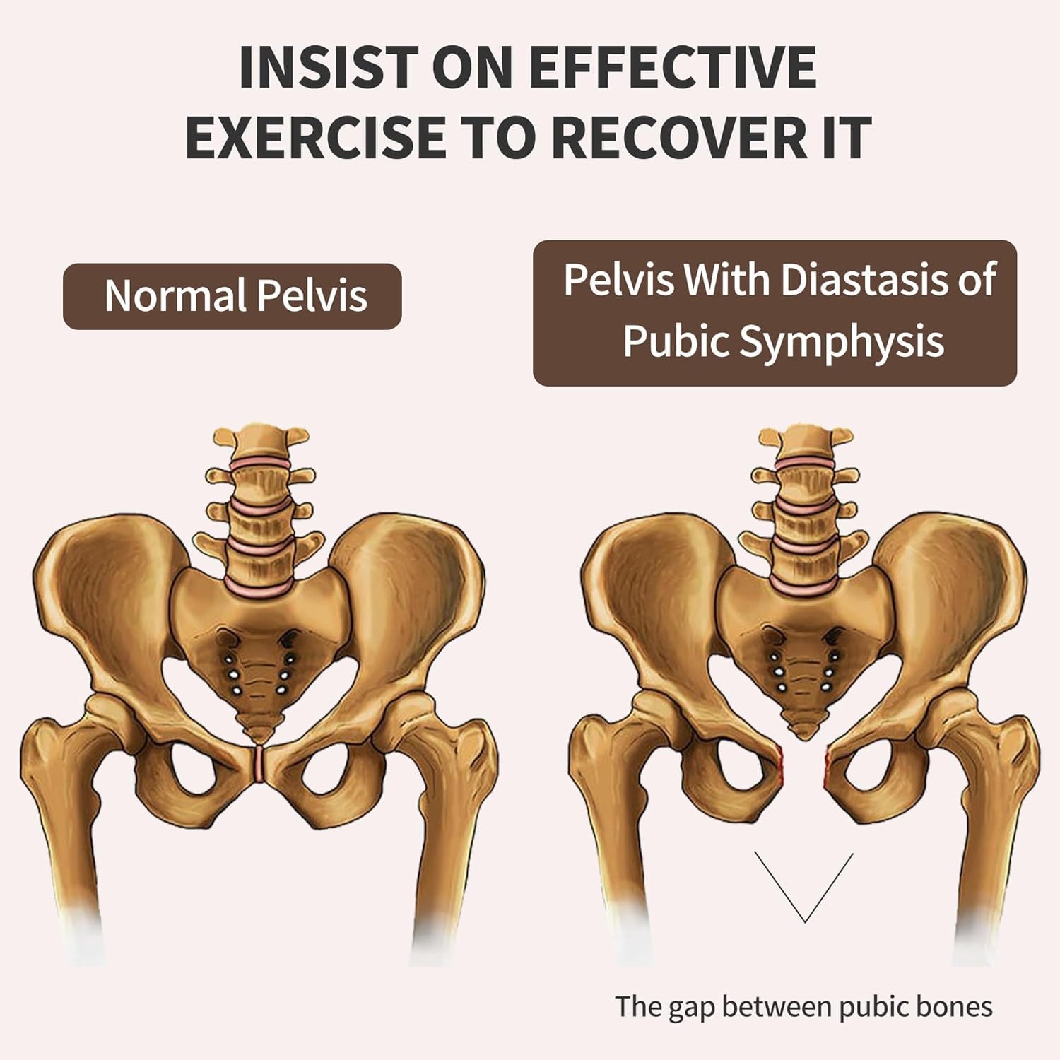 2-in-1 Beentrainer & Skimachine - 48% Korting!