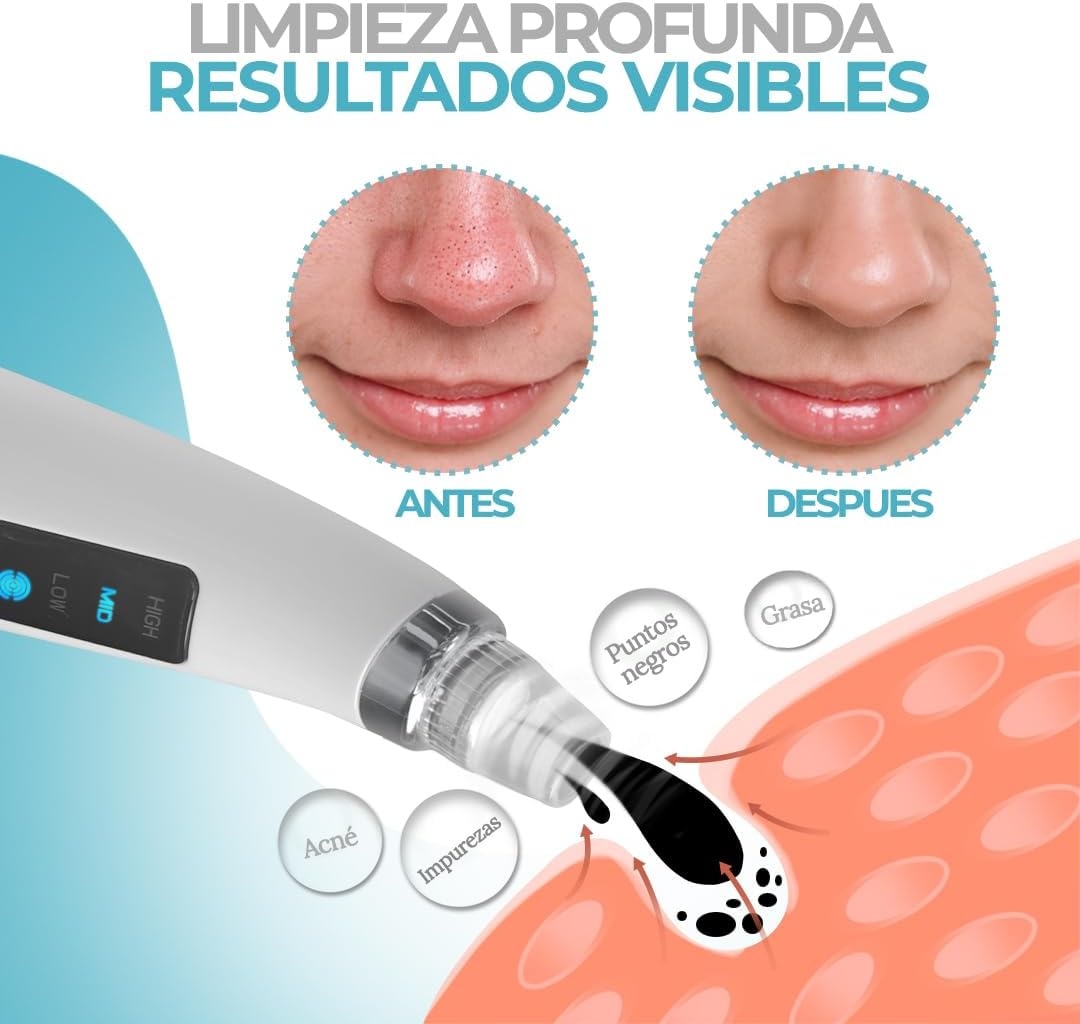 Gezichtsset met 4 stappen: Mee-eterzuiger met 5 sproeiers + elektrische gezichtsreiniger + handdoek voor het openen van poriën, extractor en poriënreiniger voor thuis