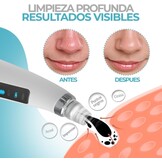 Gezichtsset 4-stappen: Mee-eterverwijderaar met 5 sproeiers, Elektrische Gezichtsreiniger 3-in-1 & Herbruikbare Gezichtsmaskerdoek