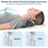 Nek- en Schouderrelaxer met Massagepunten Bovenrug - Halswervel Tractie voor TMJ Pijnverlichting & Cervicale Uitlijning, Grijs