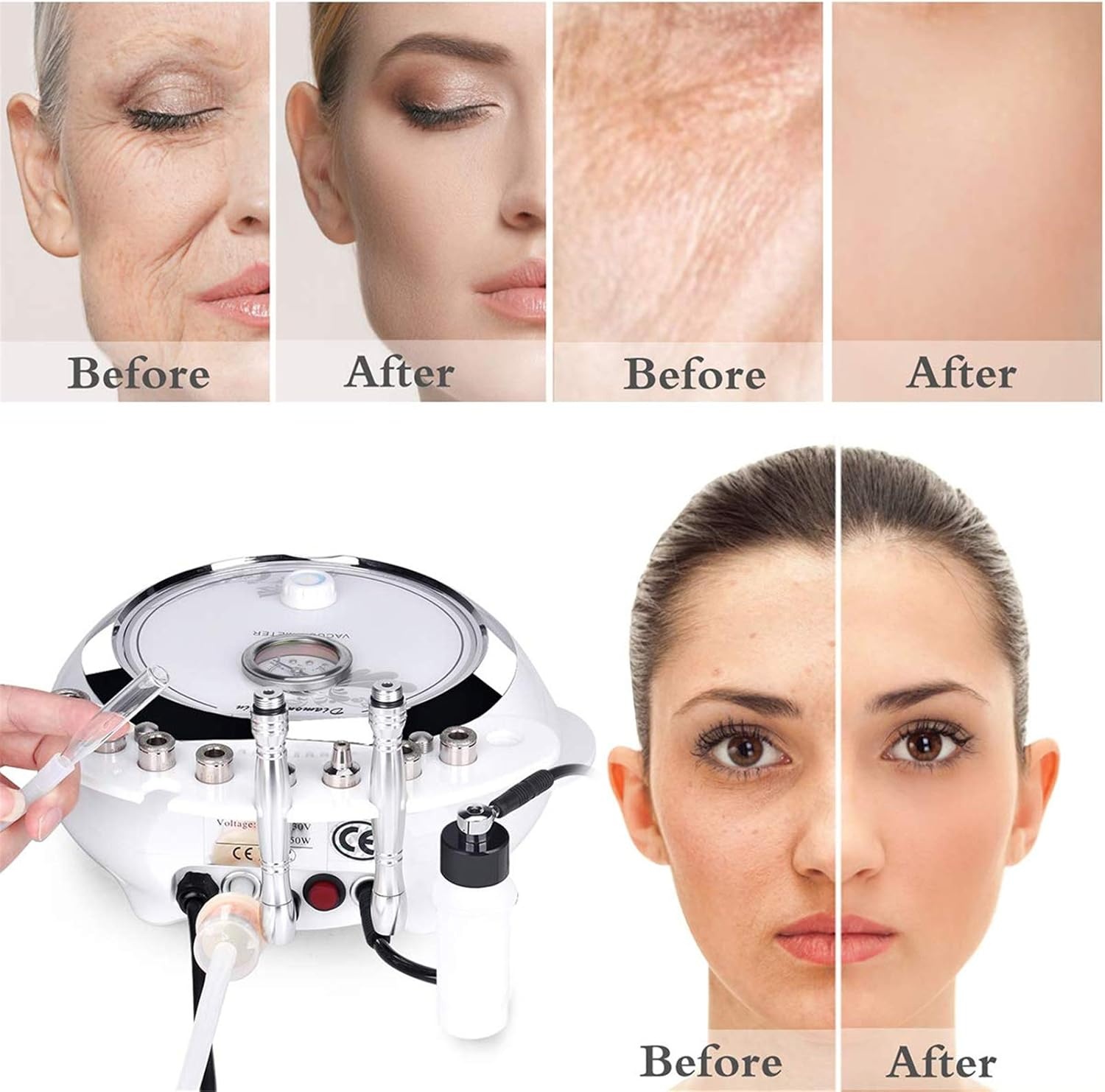 TwoWin Diamant Microdermabrasie Dermabrasie Machine, 3-in-1 Professionele Huidverjonging Acne Rimpel Behandeling Salon Apparatuur voor Gezicht met Vacuüm en Spray (Sterke Zuigkracht: 65-68 cmhg)