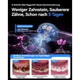 Elektrische Sonische Tandenborstel - 79% Korting