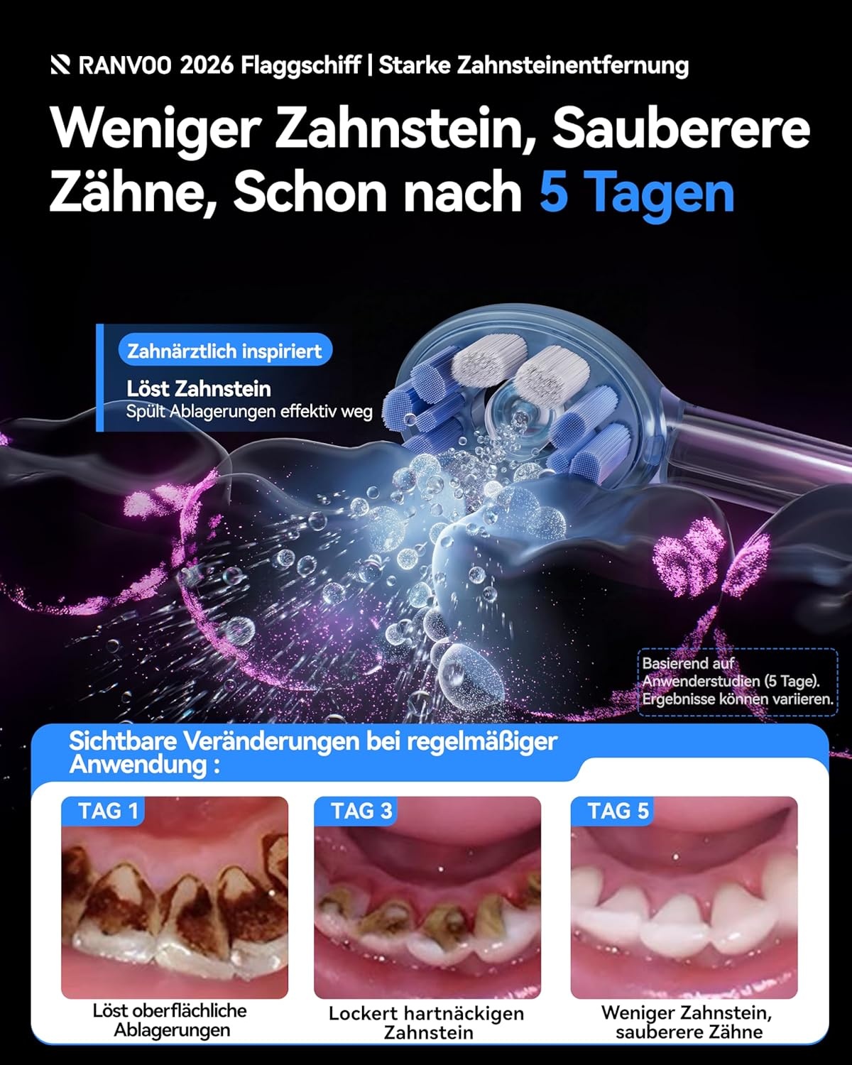 Elektrische Sonische Tandenborstel - 79% Korting