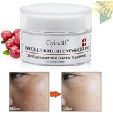 Whitening Crème 30ml: Vocht & Vitamine C voor Gelijkmatige Huid - 72% Korting