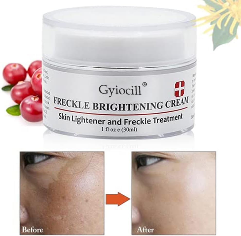 Whitening Crème 30ml: Vocht & Vitamine C voor Gelijkmatige Huid - 72% Korting