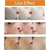Whitening Crème 30 ml: Tegen Vlekken, Hydraterend met Vitamine C | 27% Korting