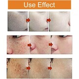 Whitening Crème 30ml: Vocht & Vitamine C voor Gelijkmatige Huid - 72% Korting