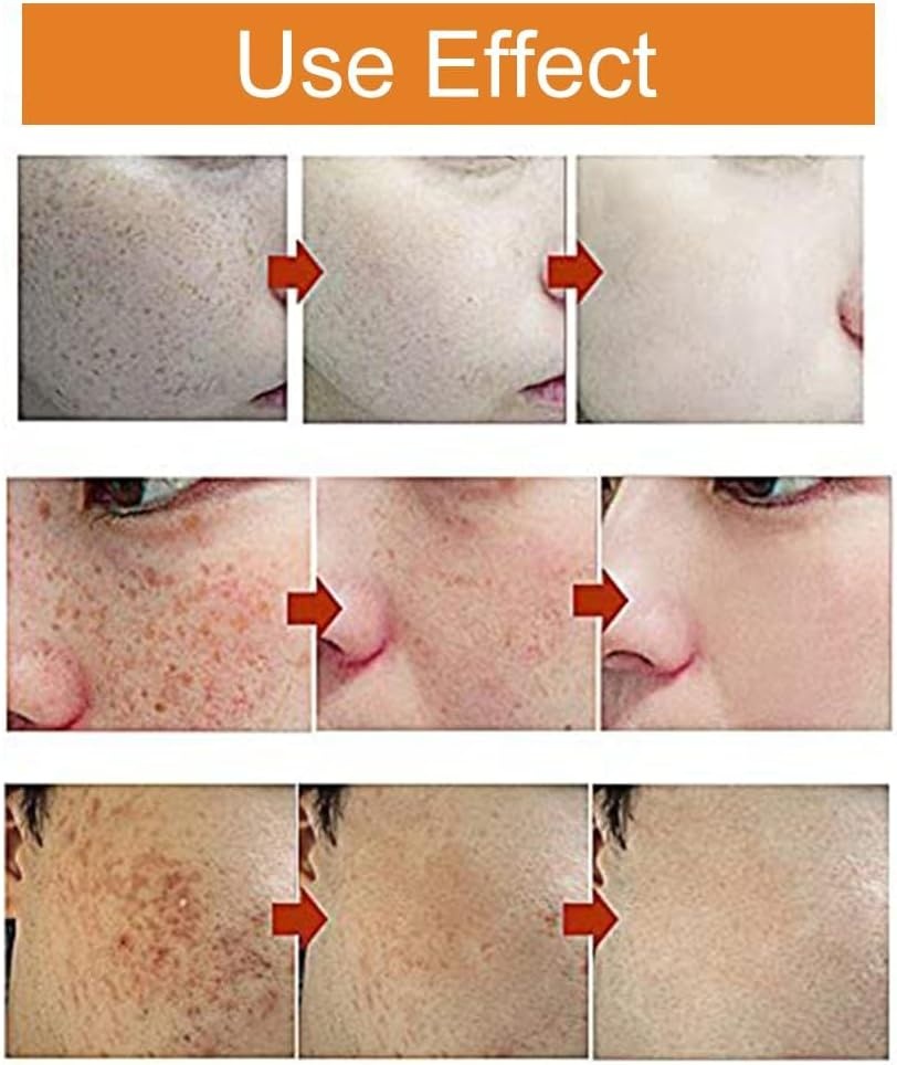 Whitening Crème 30ml: Vocht & Vitamine C voor Gelijkmatige Huid - 72% Korting