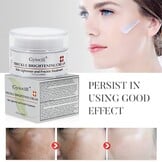Whitening Crème 30 ml: Tegen Vlekken, Hydraterend met Vitamine C | 27% Korting