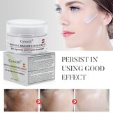 Whitening Crème 30ml: Vocht & Vitamine C voor Gelijkmatige Huid - 72% Korting