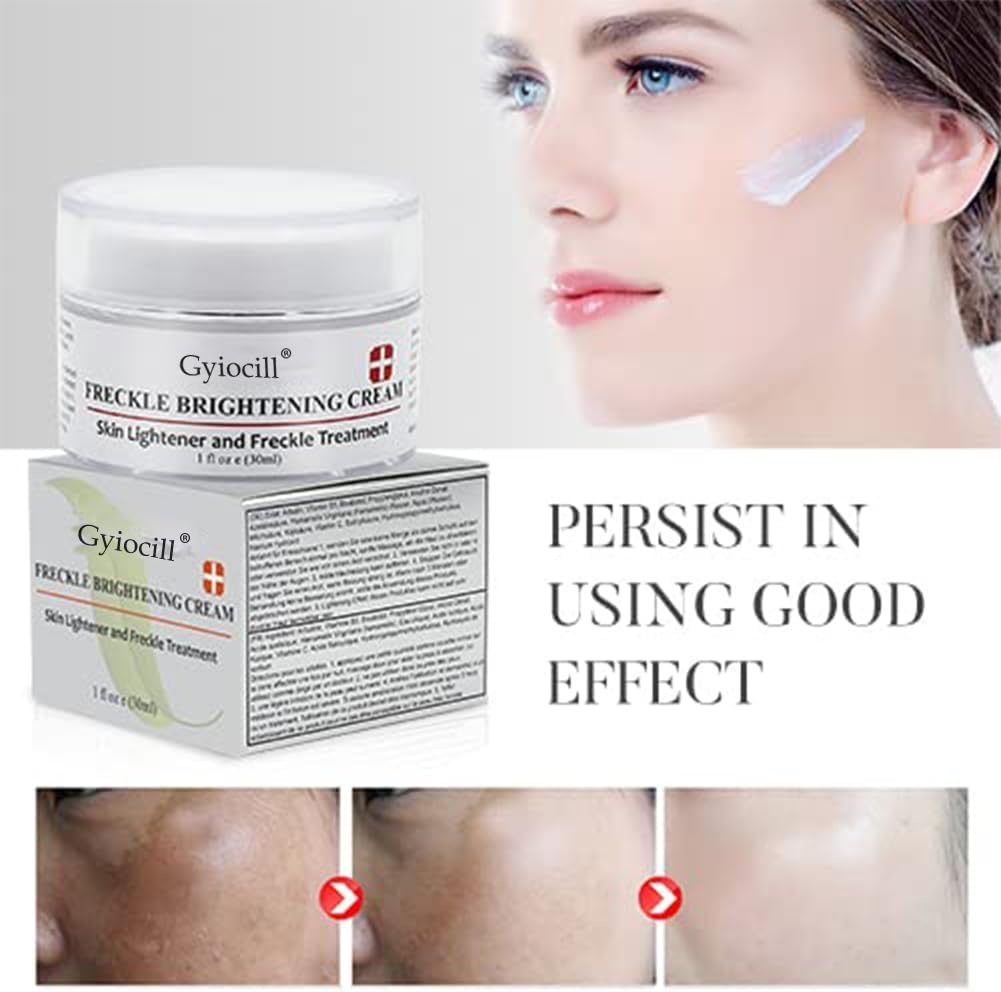 Whitening Crème 30ml: Vocht & Vitamine C voor Gelijkmatige Huid - 72% Korting
