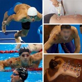 Glazen Cupping Set 14-delig: Ontspanning & Massage - 46% Korting