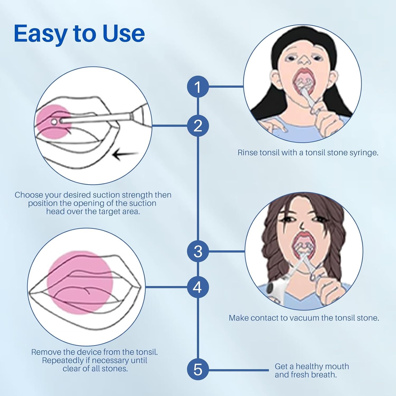 Elektrische Tonsilsteen Verwijderaar – Tonsil Stone Remover Vacuum Kit met 10 Accessoires, 6 Zuigstanden, 800mAh Oplaadbare Batterij, Compact & Draagbaar voor Thuis en Reizen