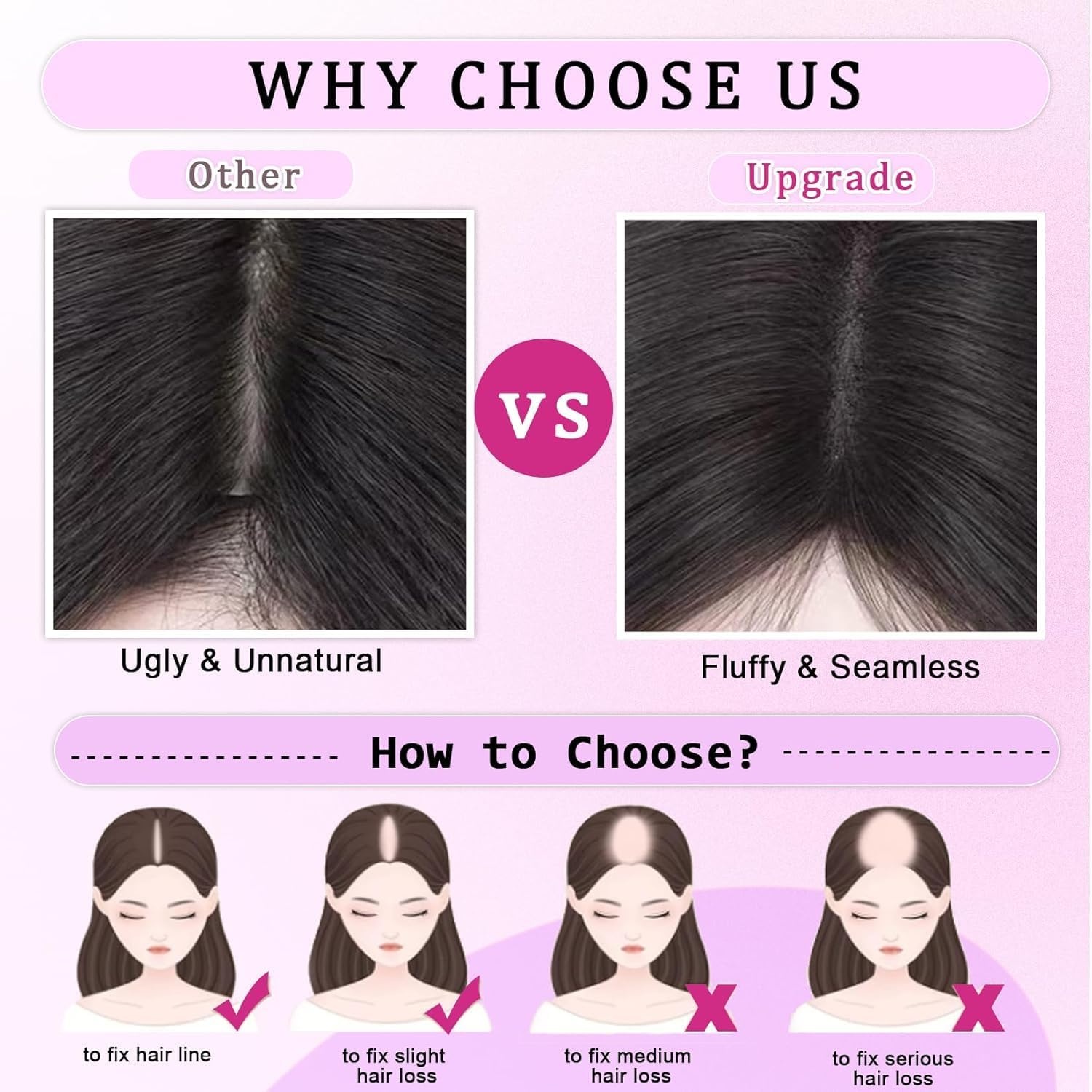 Haartopper Echt Haar Lichtbruin met Pony - 28% Korting