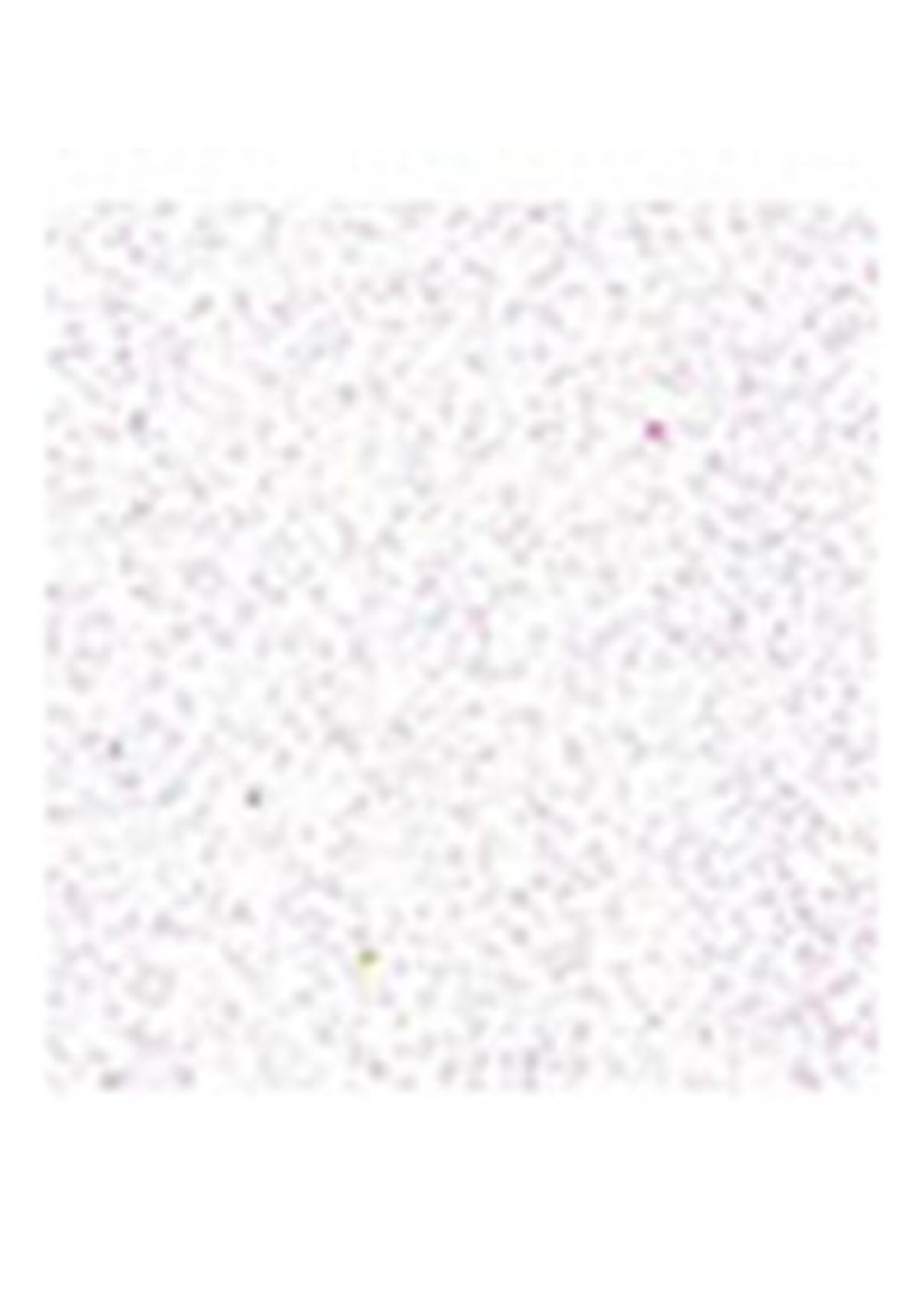 8535-00 - Foam, White Glitter