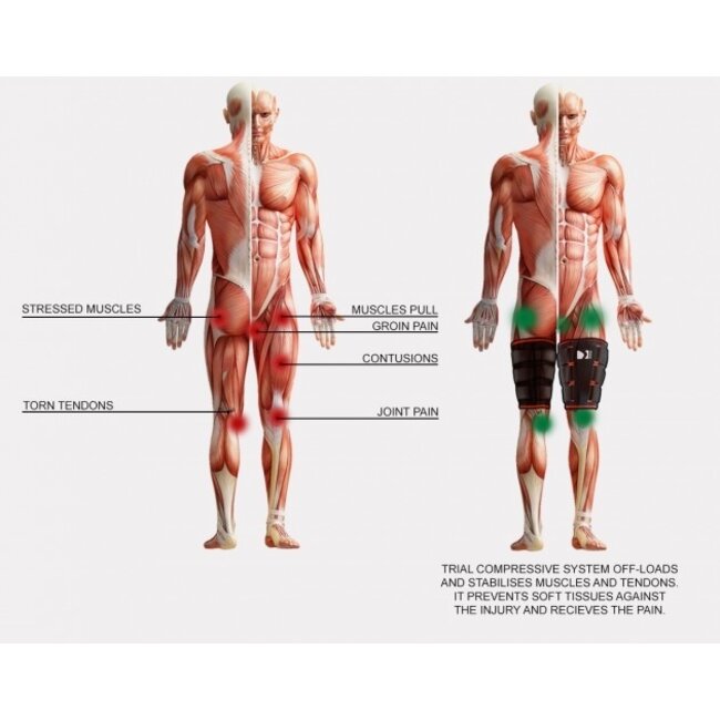 Reh4Sport Dijbeenbrace / bovenbeenbrace