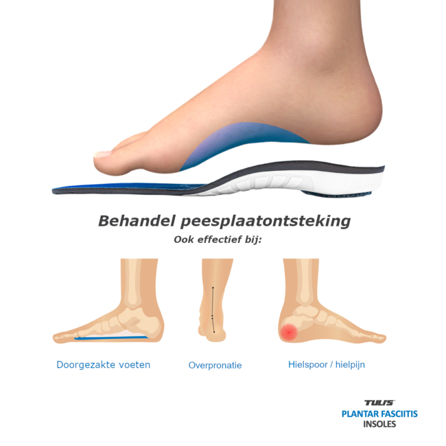 Tuli's Peesplaatontsteking steunzolen / Plantar Fascia