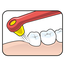 TePe TePe Interspace Soft tandenborstel (incl. 12 tips)