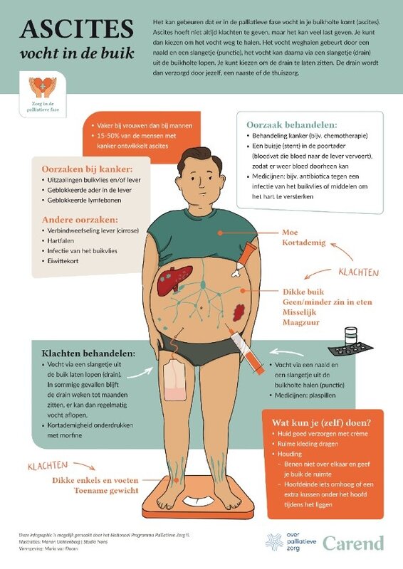 Vocht in de buikholte (Ascites) - poster