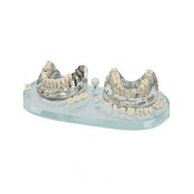 Hager Werken Transparant demomodel implantaten