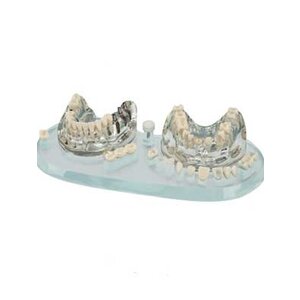 Hager Werken Transparant demomodel implantaten