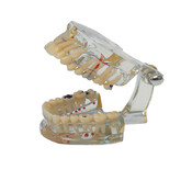 Hager Werken Transparant demomodel carieuze defecten