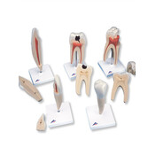 3B Klassieke reeks tandmodellen