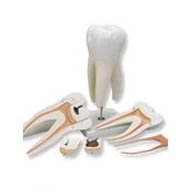 3B Bovenmolaar op standaard