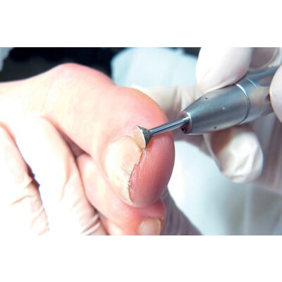 Busch Side Grip middel geen ring