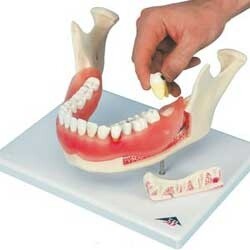 Demonstratiemodellen Dental
